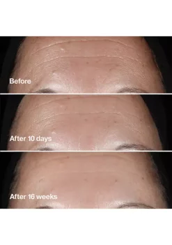 Top 10 ❤️ Clinique Smart Clinical Repair™ Wrinkle Correcting Serum ✨ -Cosmetic Shop Belk 1569