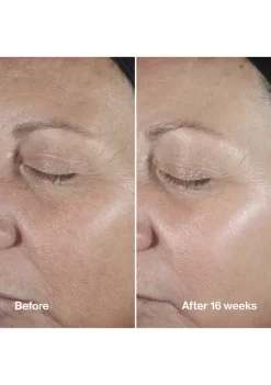 Top 10 ❤️ Clinique Smart Clinical Repair™ Wrinkle Correcting Serum ✨ -Cosmetic Shop Belk 1570