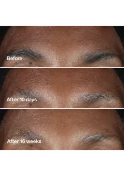 Top 10 ❤️ Clinique Smart Clinical Repair™ Wrinkle Correcting Serum ✨ -Cosmetic Shop Belk 1574