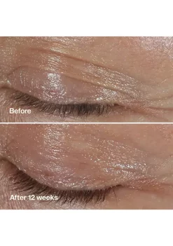 Discount ⌛ Clinique Smart Clinical Repair™ Wrinkle Correcting Eye Cream ⭐ -Cosmetic Shop Belk 1689