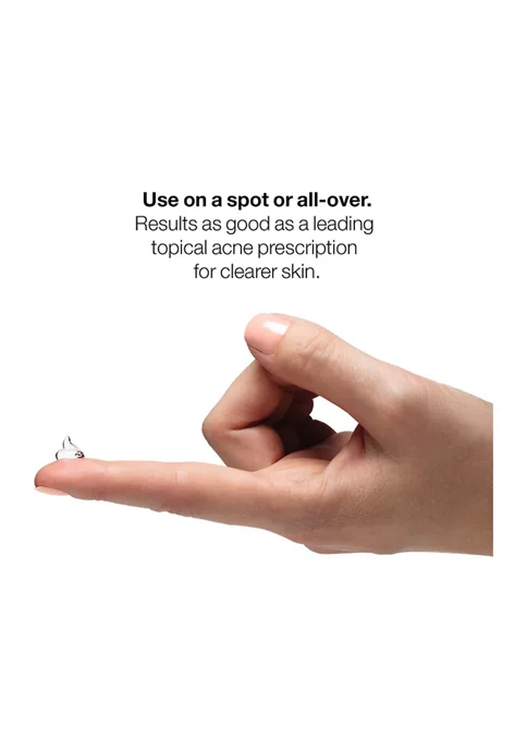 Best Pirce 😀 Clinique Acne Solutions™ Clinical Clearing Gel 💯 4 Best Pirce 😀 Clinique Acne Solutions™ Clinical Clearing Gel 💯 - Image 4